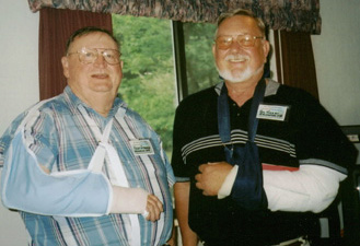 Two guys pose with casts on their arms